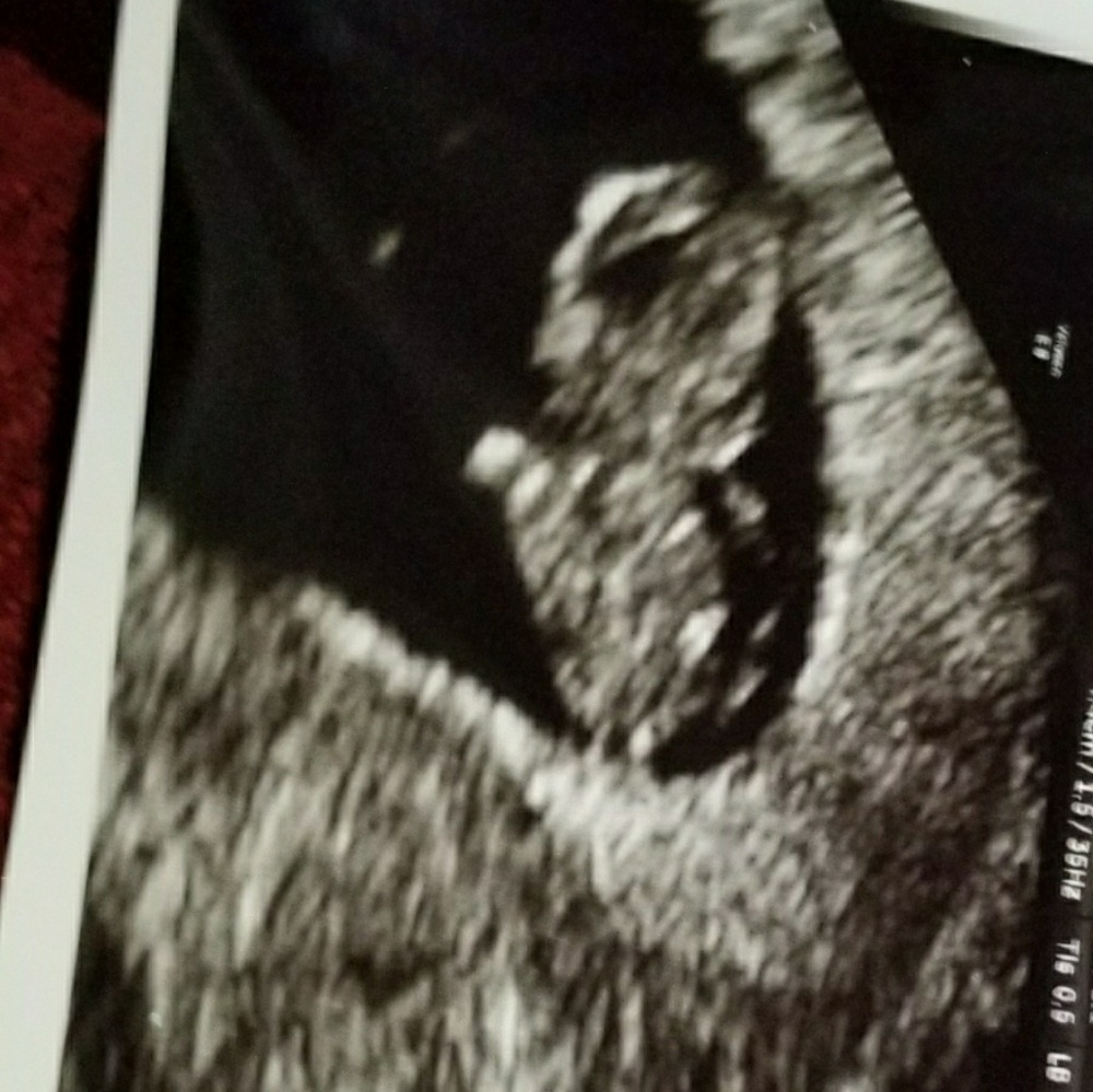 Announcement, baby C coming in December